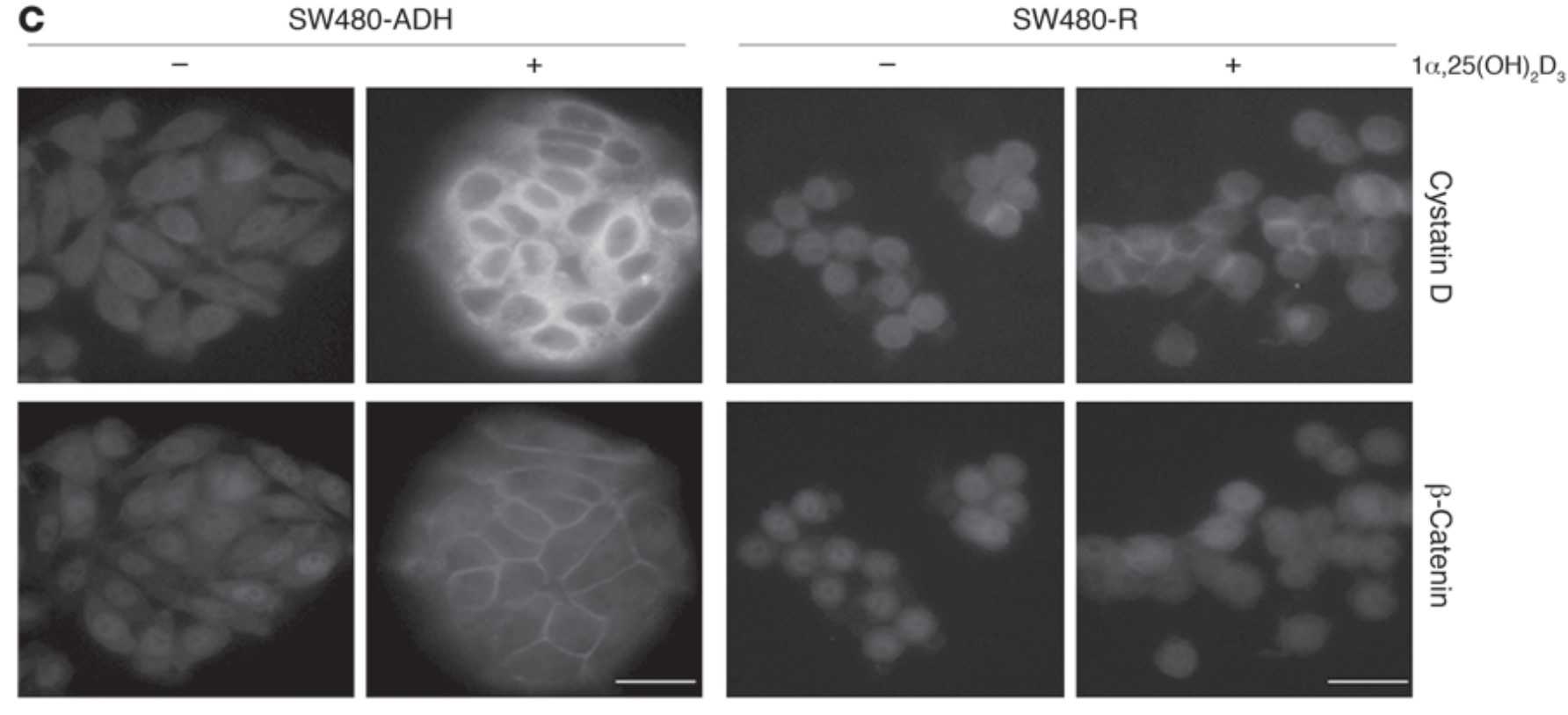 Immunofluorescence analysis of cystatin D induction.jpg